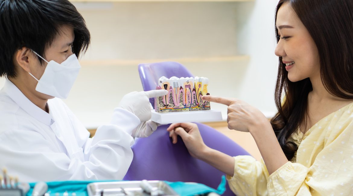 Dental implants